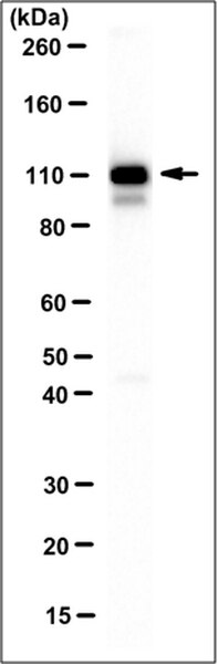 Anti-Filamin A Antibody, clone TI10, Ascites Free | MAB1680-C